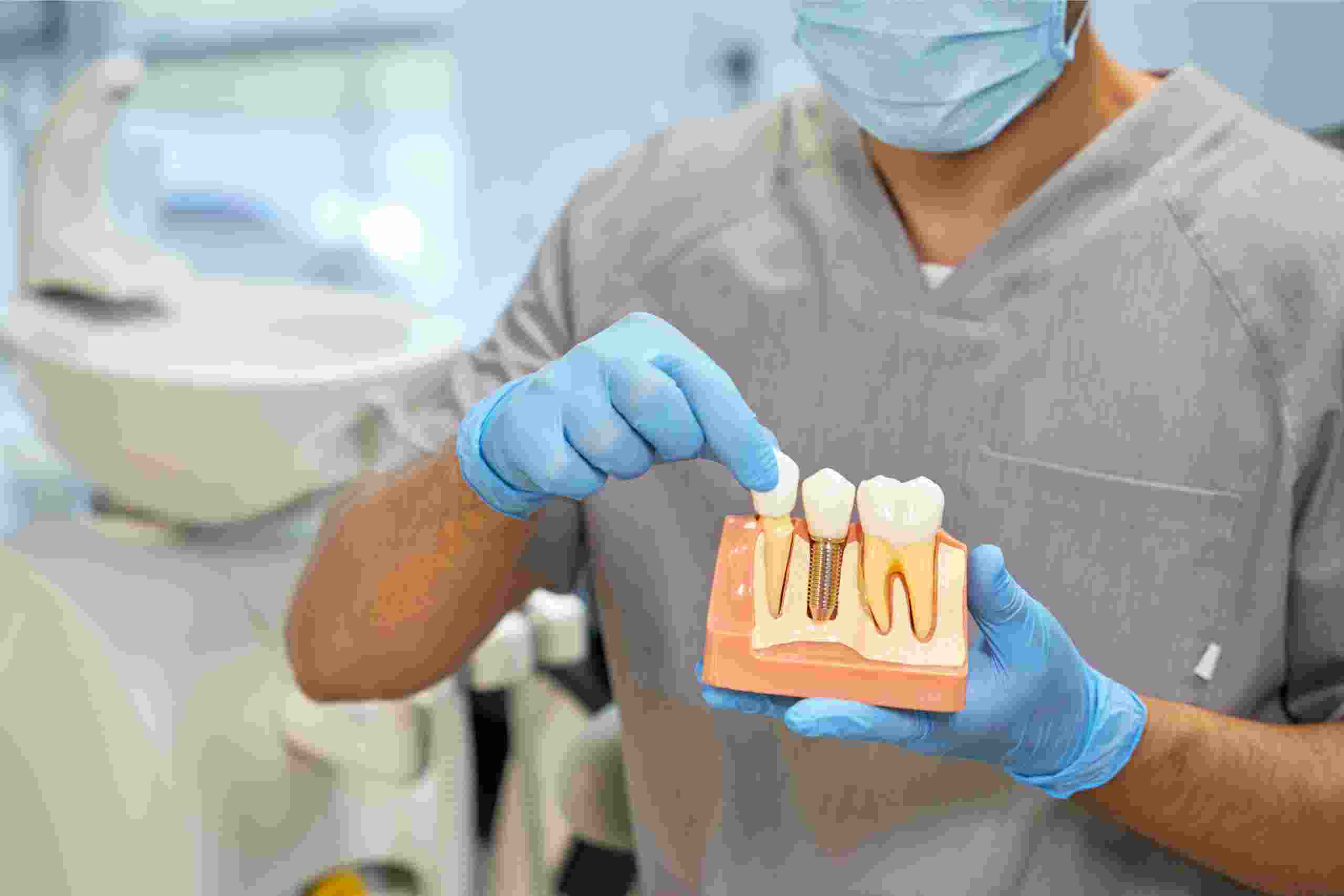 Dental Implants Tupelo MS